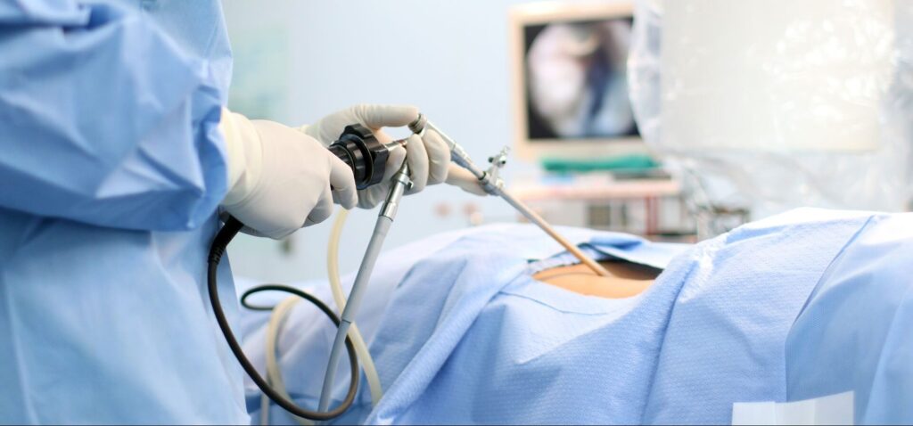 endoscopic surgery